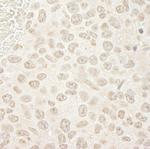 PPP3CA Antibody in Immunohistochemistry (IHC)