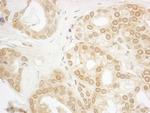 PPP3CA Antibody in Immunohistochemistry (IHC)