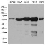 PPP3CA Antibody in Western Blot (WB)