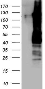 PPP6R2 Antibody in Western Blot (WB)