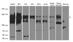 PPP6R2 Antibody in Western Blot (WB)