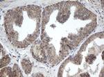 PPT1 Antibody in Immunohistochemistry (Paraffin) (IHC (P))