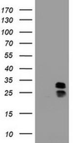 PPT1 Antibody in Western Blot (WB)