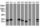 PPT1 Antibody in Western Blot (WB)