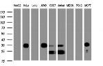 PPT1 Antibody in Western Blot (WB)