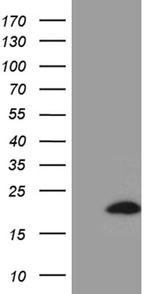 PRDX5 Antibody in Western Blot (WB)