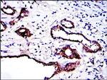 PKN2 Antibody in Immunohistochemistry (Paraffin) (IHC (P))