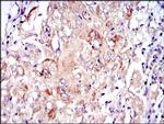 PKN2 Antibody in Immunohistochemistry (Paraffin) (IHC (P))