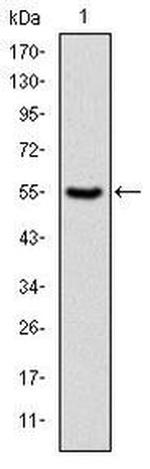 PKN2 Antibody in Western Blot (WB)