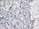 PRKAR1A Antibody in Immunohistochemistry (Paraffin) (IHC (P))