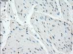 PRKAR1A Antibody in Immunohistochemistry (Paraffin) (IHC (P))