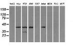 PRKAR1A Antibody in Western Blot (WB)