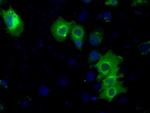 PRKAR2A Antibody in Immunocytochemistry (ICC/IF)
