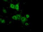 PRKAR2A Antibody in Immunocytochemistry (ICC/IF)