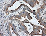 PRKAR2A Antibody in Immunohistochemistry (Paraffin) (IHC (P))