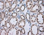 PRKAR2A Antibody in Immunohistochemistry (Paraffin) (IHC (P))