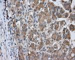 PRKAR2A Antibody in Immunohistochemistry (Paraffin) (IHC (P))