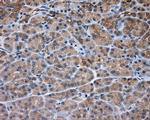 PRKAR2A Antibody in Immunohistochemistry (Paraffin) (IHC (P))