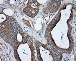 PRKAR2A Antibody in Immunohistochemistry (Paraffin) (IHC (P))