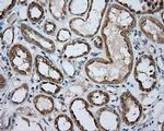 PRKAR2A Antibody in Immunohistochemistry (Paraffin) (IHC (P))