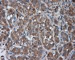 PRKAR2A Antibody in Immunohistochemistry (Paraffin) (IHC (P))