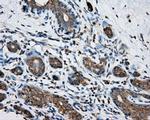 PRKAR2A Antibody in Immunohistochemistry (Paraffin) (IHC (P))