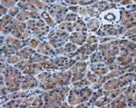 PRKAR2A Antibody in Immunohistochemistry (Paraffin) (IHC (P))