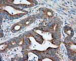 PRKAR2A Antibody in Immunohistochemistry (Paraffin) (IHC (P))