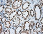 PRKAR2A Antibody in Immunohistochemistry (Paraffin) (IHC (P))