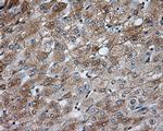 PRKAR2A Antibody in Immunohistochemistry (Paraffin) (IHC (P))