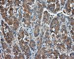 PRKAR2A Antibody in Immunohistochemistry (Paraffin) (IHC (P))