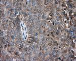 PRKAR2A Antibody in Immunohistochemistry (Paraffin) (IHC (P))