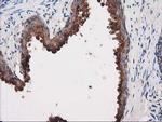 PRKAR2A Antibody in Immunohistochemistry (Paraffin) (IHC (P))