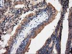 PRKAR2A Antibody in Immunohistochemistry (Paraffin) (IHC (P))