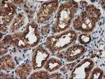 PRKAR2A Antibody in Immunohistochemistry (Paraffin) (IHC (P))