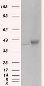 PRKAR2A Antibody in Western Blot (WB)