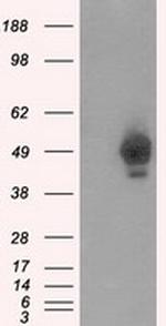 PRKAR2A Antibody in Western Blot (WB)