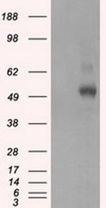 PRKAR2A Antibody in Western Blot (WB)