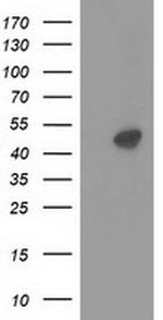 PRKAR2A Antibody in Western Blot (WB)