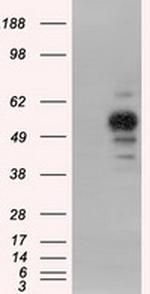 PRKAR2A Antibody in Western Blot (WB)