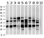 PRKAR2A Antibody in Western Blot (WB)