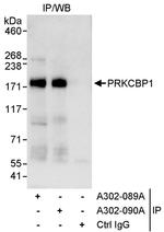 PRKCBP1 Antibody in Immunoprecipitation (IP)