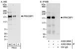 PRKCBP1 Antibody in Western Blot (WB)