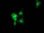 PRKCE Antibody in Immunocytochemistry (ICC/IF)