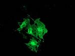 PRKCE Antibody in Immunocytochemistry (ICC/IF)