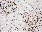 PRKCE Antibody in Immunohistochemistry (Paraffin) (IHC (P))