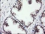 PRKCE Antibody in Immunohistochemistry (Paraffin) (IHC (P))