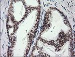 PRKCE Antibody in Immunohistochemistry (Paraffin) (IHC (P))