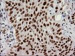 PRKCE Antibody in Immunohistochemistry (Paraffin) (IHC (P))