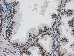 PRKCE Antibody in Immunohistochemistry (Paraffin) (IHC (P))